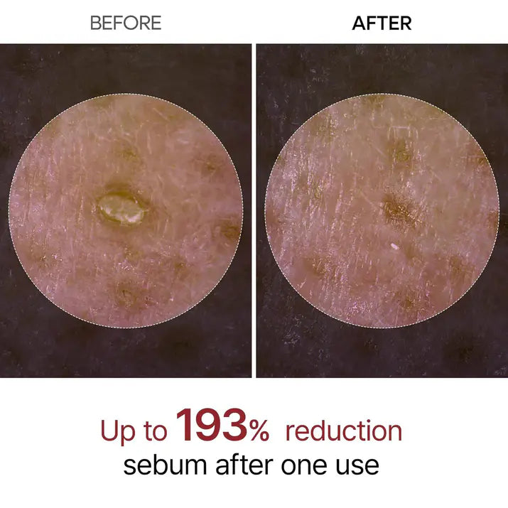 Dr. Melaxin™ RiceGlow Renewal Ampoule Brightening & Exfoliating Peeling Serum